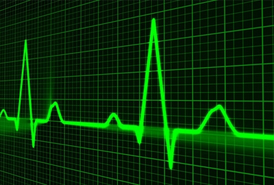 Battery Life Testing and Diagnosis, impedance testing, voltage testing.